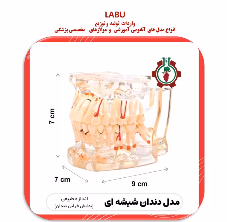 مدل دندان شیشه ای مدل خرابی دندان