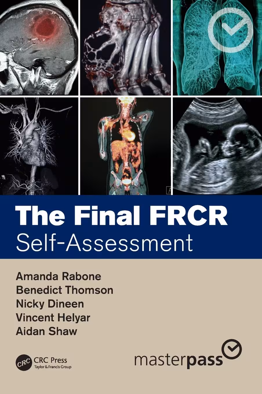 خرید و دانلود نسخه کامل کتاب The Final FRCR: Self-Assessment