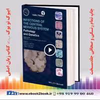 Infections of the Central Nervous System