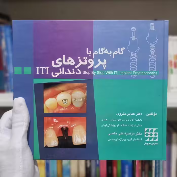 کتاب گام به گام با پروتز های دندانی ایمپلنت ITI چاپ 1386