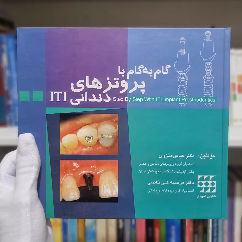 کتاب گام به گام با پروتز های دندانی ایمپلنت ITI چاپ 1386