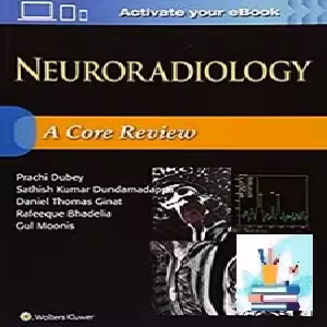 Neuroradiology CONVERTEF PDF price 1€