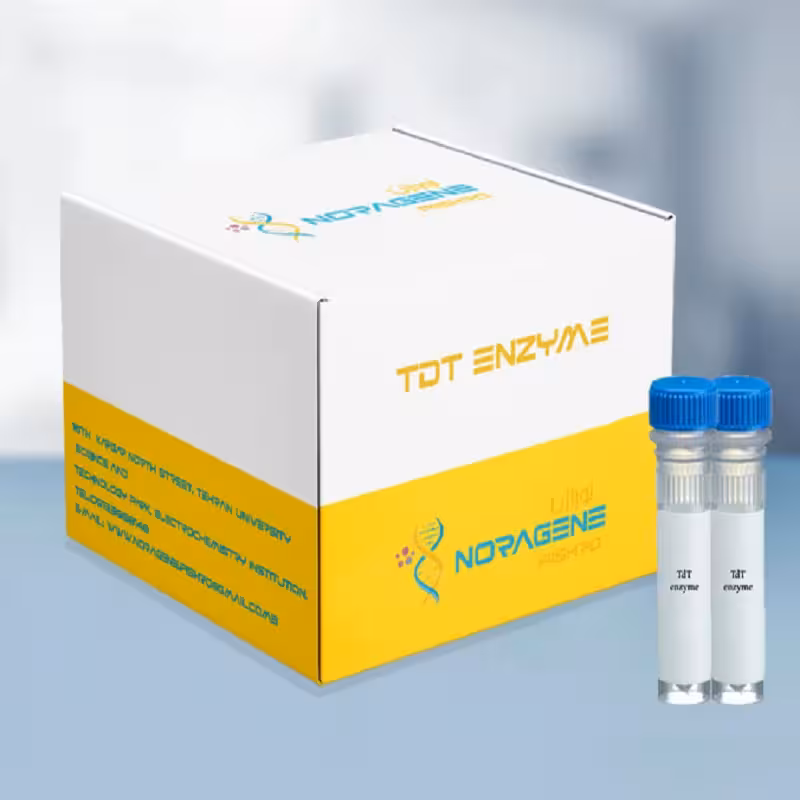 آنزیم دئوکسی نوکلئوتیدیل ترانسفراز انتهایی