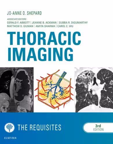 خرید و دانلود نسخه کامل کتاب Thoracic Imaging: The Requisites (Requisites in Radiology)
