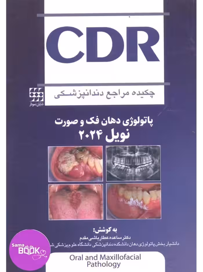 CDR پاتولوژی دهان فک و صورت نویل 2024 (چکیده مراجع دندانپزشکی)