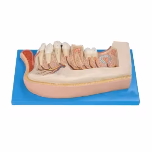 مولاژ آرواره پایین اطفال تا 12 سال