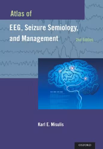 خرید و دانلود نسخه کامل کتاب Atlas of EEG, Seizure Semiology, and Management