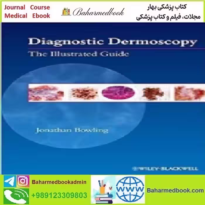 Diagnostic Dermoscopy The Illustrated Guid TRUE PDF price 1€ - کتاب پزشکی بهار