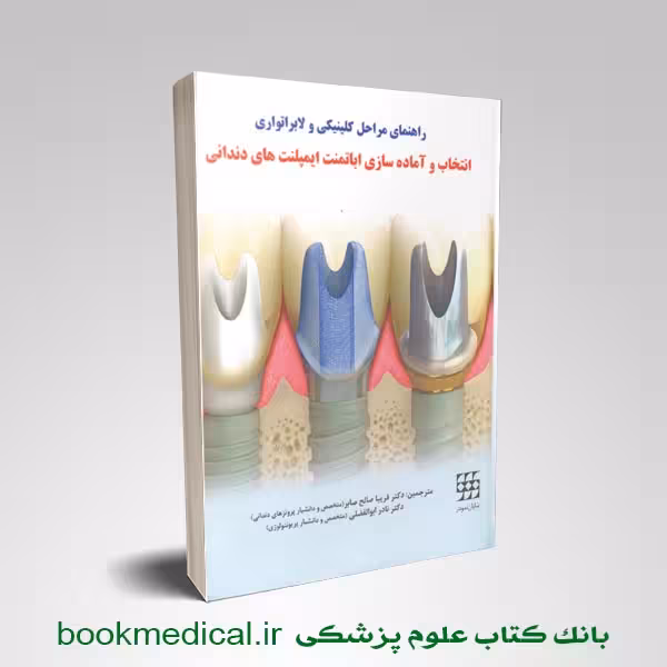 راهنمای مراحل کلینیکی و لابراتواری انتخاب و آماده‌سازی اباتمنت ایمپلنت‌های دندانی