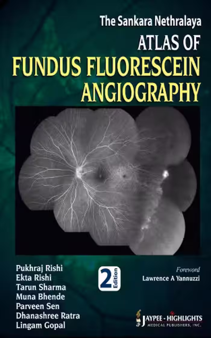 خرید و دانلود نسخه کامل کتاب The Sankara Nethralaya Atlas of Fundus Fluorescein Angiography