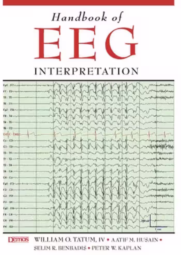 خرید و دانلود نسخه کامل کتاب Handbook of EEG Interpretation