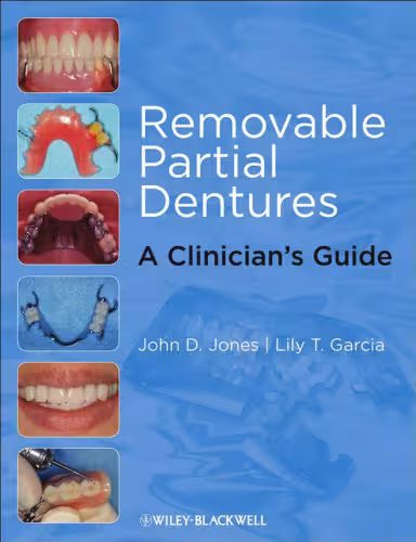خرید و دانلود نسخه کامل کتاب Removable Partial Dentures: A Clinician's Guide (Restorative Dentistry)