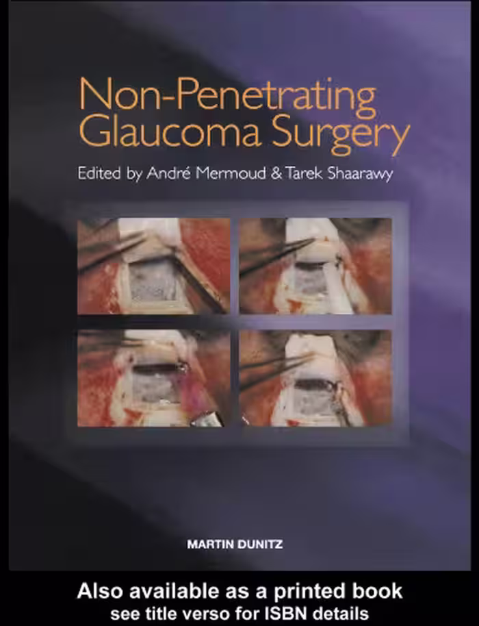 خرید و دانلود نسخه کامل کتاب Non-Penetrating Glaucoma Surgery