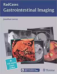 خرید و دانلود نسخه کامل کتاب Radcases Gastrointestinal Imaging (Radcases Plus Q&amp;A) - Original PDF