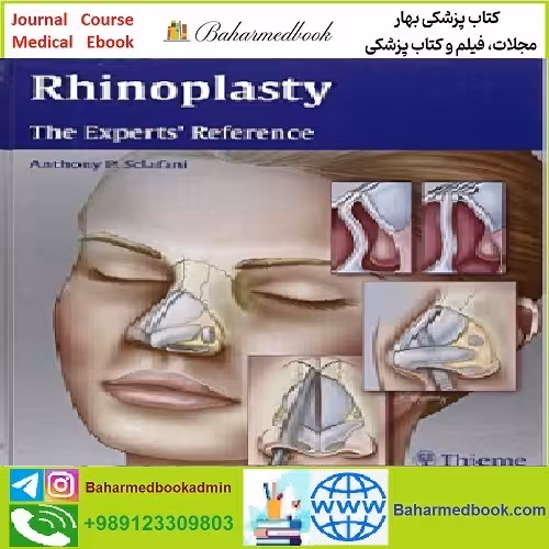 Rhinoplasty The Experts' Reference TRUE PDF price 1€ - کتاب پزشکی بهار