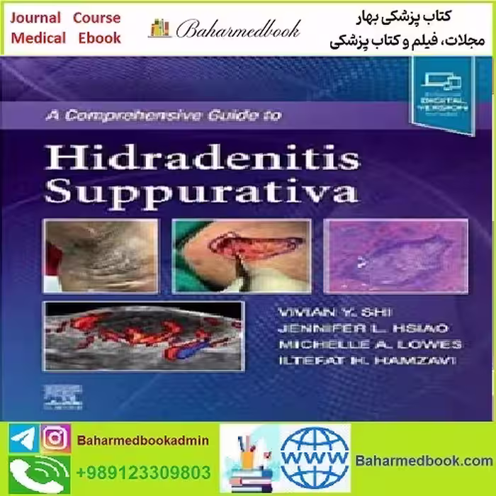 A Comprehensive Guide to Hidradenitis Suppurativa TRUE PDF
