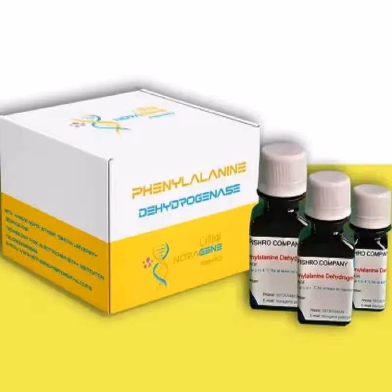 آنزیم فنیل آلانین دهیدروژناژ