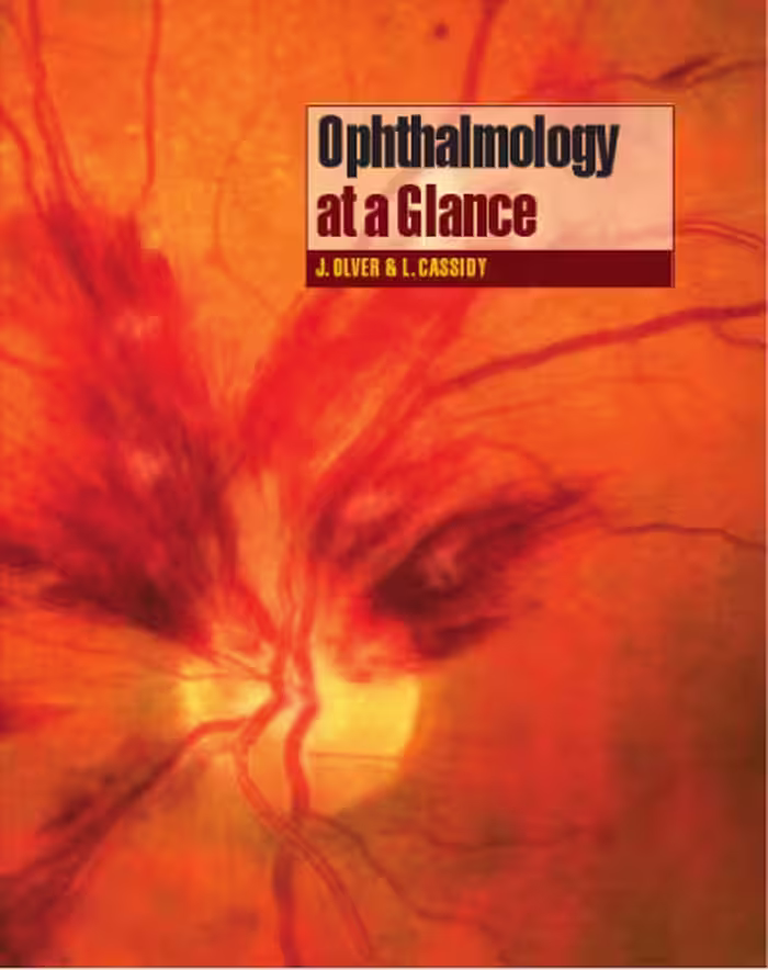 خرید و دانلود نسخه کامل کتاب Ophthalmology At a Glance