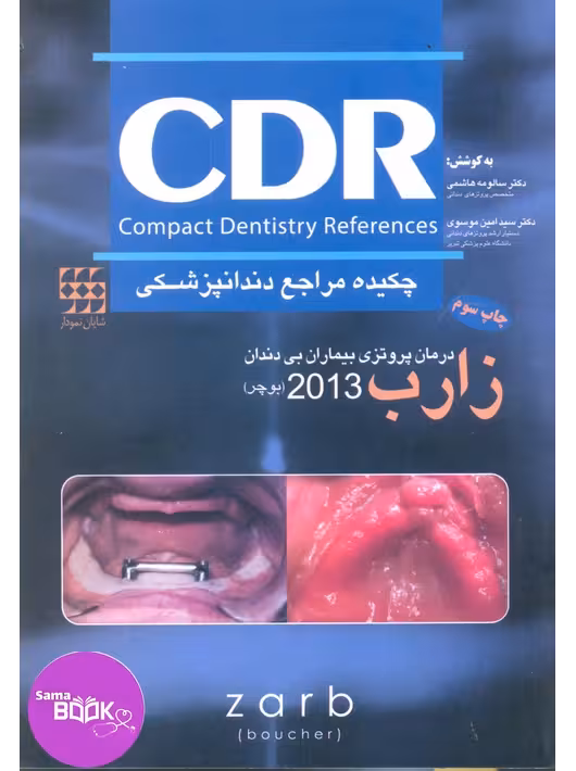 CDR درمان پروتزی بیماران بی دندان زارب(بوچر) 2013 (چکیده مراجع دندانپزشکی)