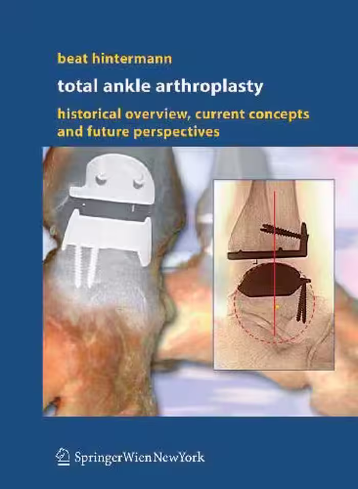 خرید و دانلود نسخه کامل کتاب Total Ankle Arthroplasty