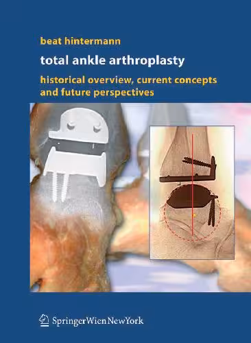 خرید و دانلود نسخه کامل کتاب Total Ankle Arthroplasty