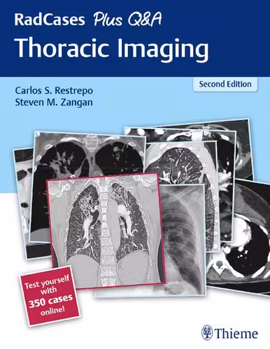خرید و دانلود نسخه کامل کتاب RadCases Plus Q&amp;A Thoracic Imaging