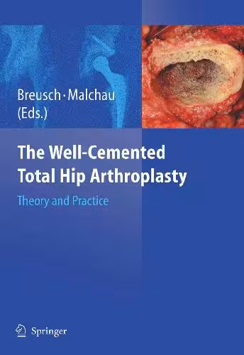 خرید و دانلود نسخه کامل کتاب The Well-cemented Total Hip Arthroplasty