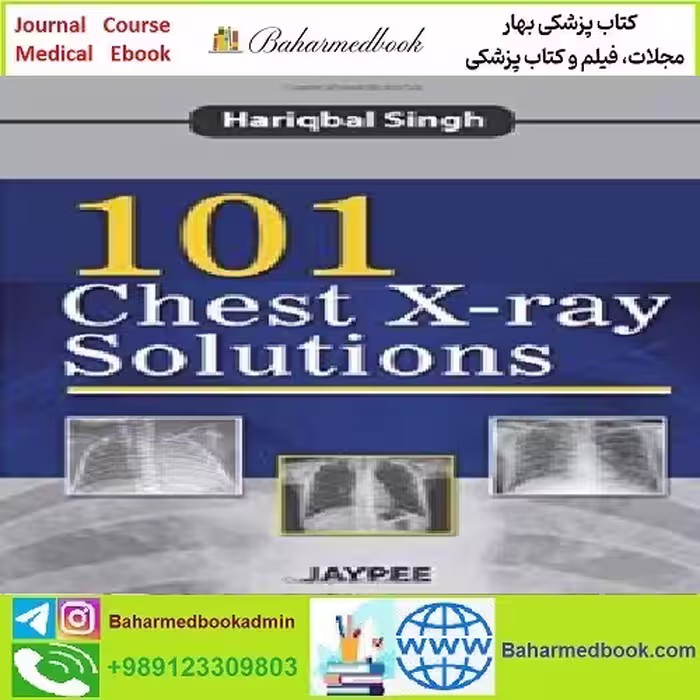 101Chest X ray Solutions TRUE PDF price 1€ - کتاب پزشکی بهار