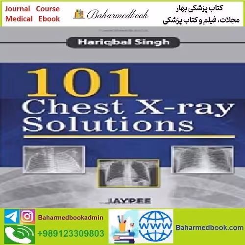 101Chest X ray Solutions TRUE PDF price 1€ - کتاب پزشکی بهار