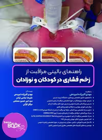 راهنمای بالینی مراقبت از زخم فشاری در کودکان و نوزادان