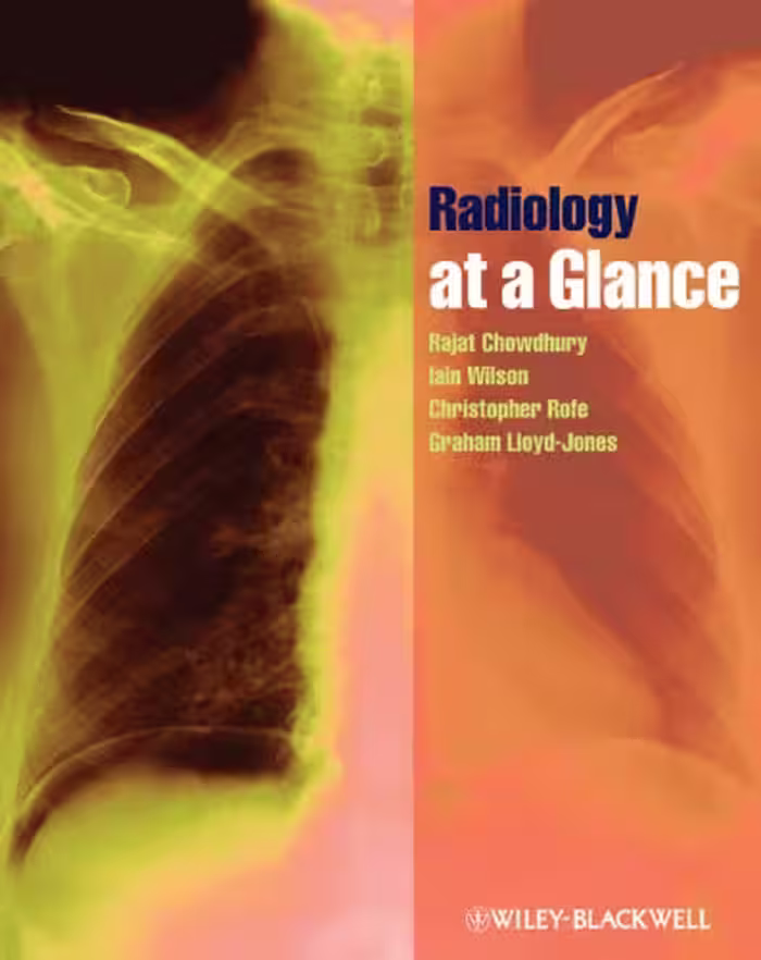خرید و دانلود نسخه کامل کتاب Radiology at a Glance.