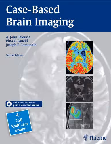 خرید و دانلود نسخه کامل کتاب Case-Based Brain Imaging