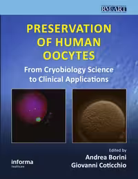 خرید و دانلود نسخه کامل کتاب Preservation of Human Oocytes (Reproductive Medicine and Assisted Reproductive Techniques)