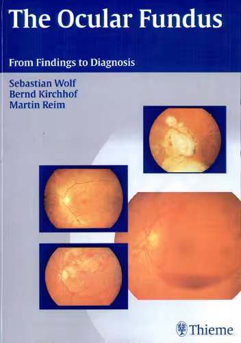 خرید و دانلود نسخه کامل کتاب The Ocular Fundus: From Findings to Diagnosis
