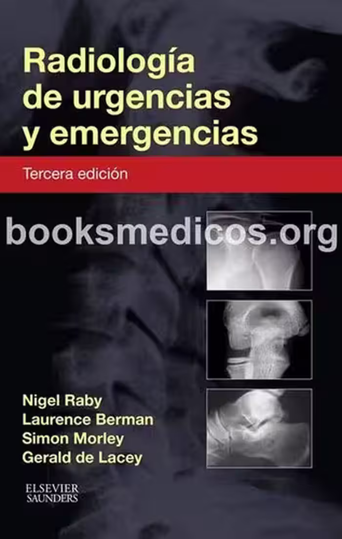 خرید و دانلود نسخه کامل کتاب Radiología de Urgencias y Emergencias