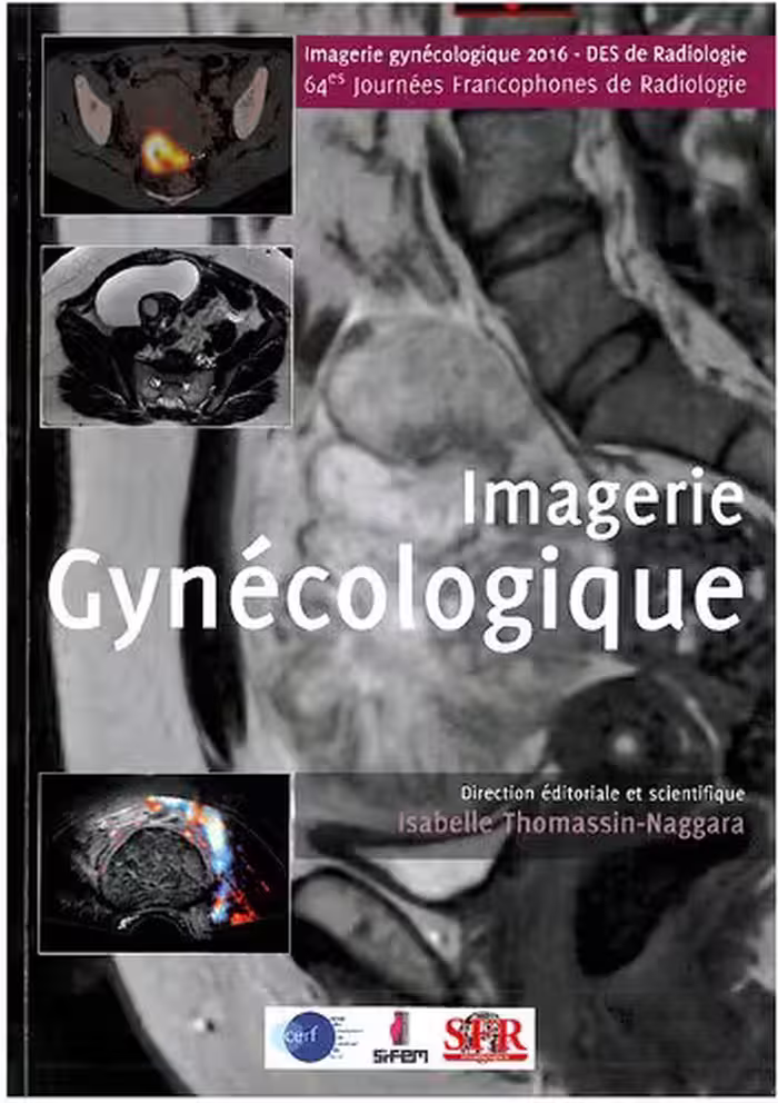 خرید و دانلود نسخه کامل کتاب Syllabus Imagerie Gynécologique