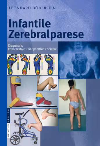 خرید و دانلود نسخه کامل کتاب Infantile Zerebralparese: Diagnostik, konservative und operative Therapie
