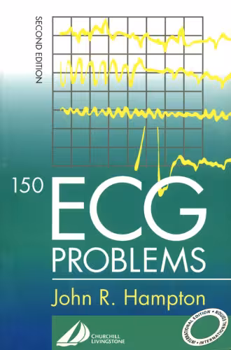 خرید و دانلود نسخه کامل کتاب 150 ECG Problems