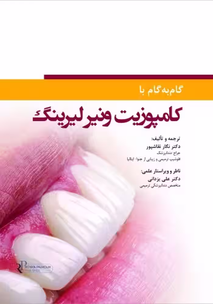 گام به گام با کامپوزیت ونیر لیرینگ
