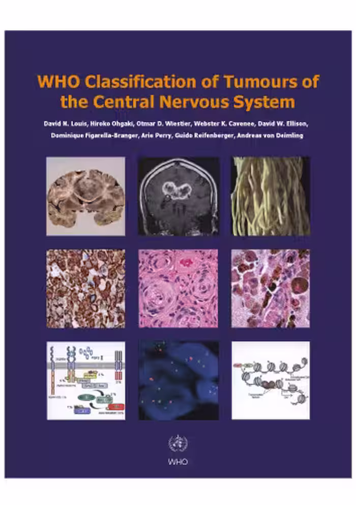 خرید و دانلود نسخه کامل کتاب WHO Classification of Tumours of the Central Nervous System