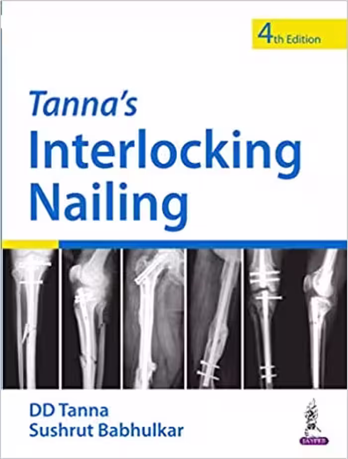 خرید و دانلود نسخه کامل کتاب Tanna’s Interlocking Nailing (4th Edition) - Original PDF