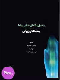 بازسازی فضای داخل ریشه: پست های زیبایی