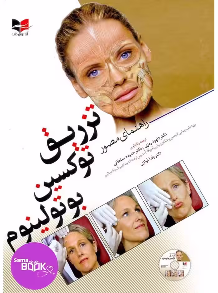 راهنمای مصور تزریق توکسین بوتولینوم