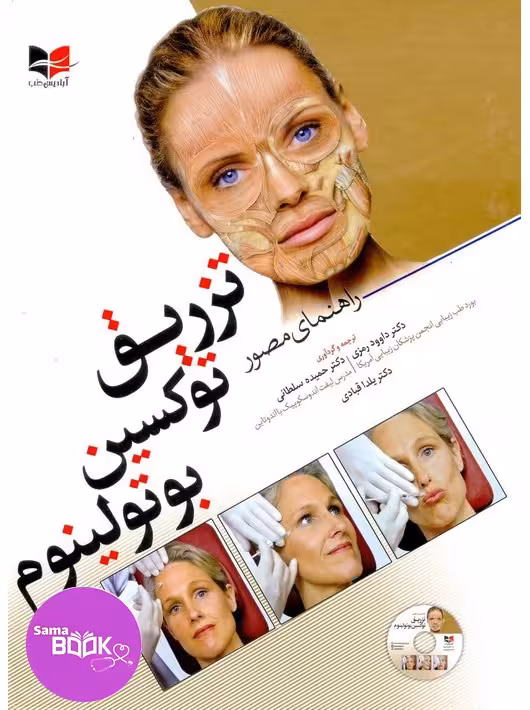 راهنمای مصور تزریق توکسین بوتولینوم