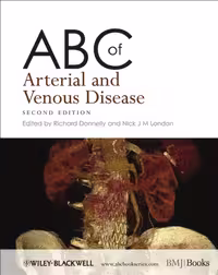 خرید و دانلود نسخه کامل کتاب ABC of Arterial and Venous Disease
