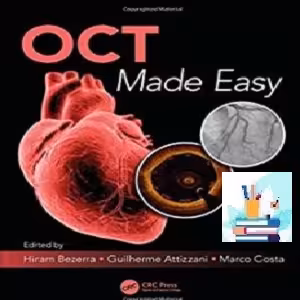 OCT Made Easy TRUE PDF price 1€