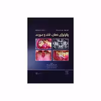 کتاب پاتولوژی دهان، فک و صورت نویل 2024 جلد دوم