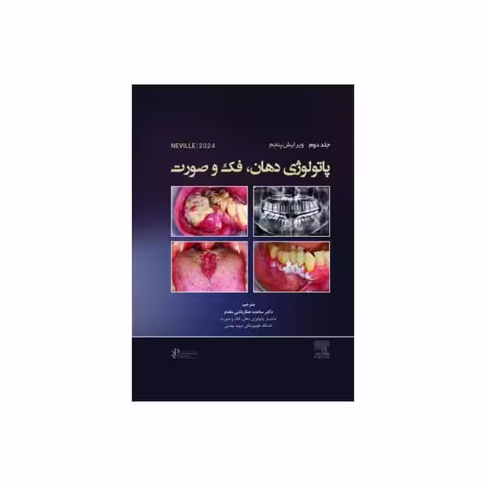 کتاب پاتولوژی دهان، فک و صورت نویل 2024 جلد دوم