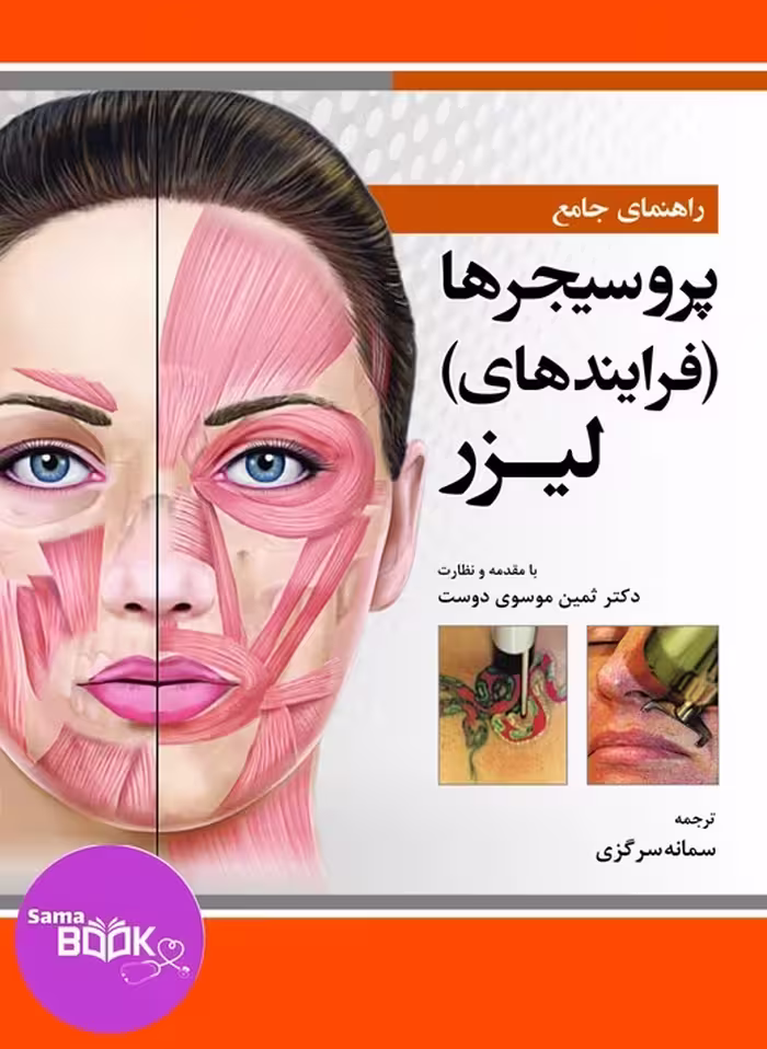 راهنمای جامع پروسیجرها (فرایندهای) لیزر