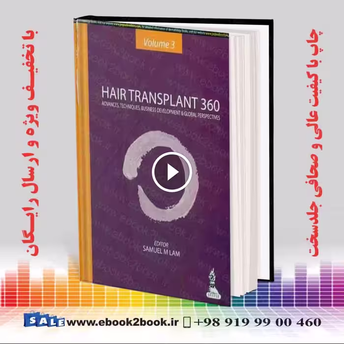 Hair Transplant 360